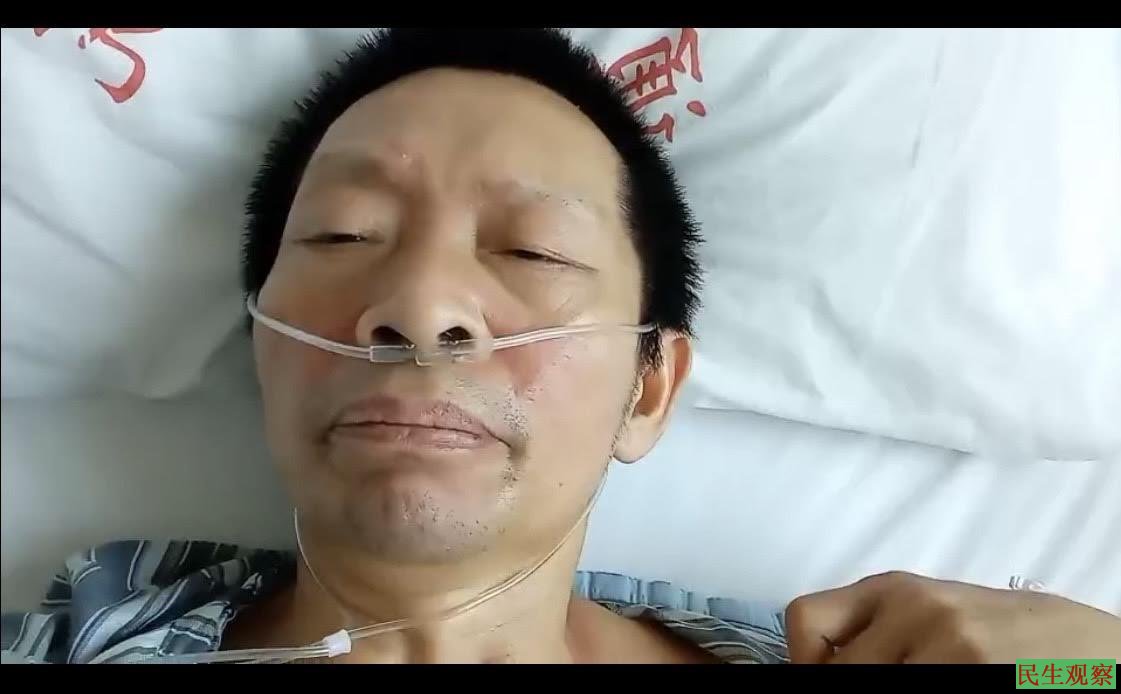 张岳兵被村干部等人打至肋骨骨折